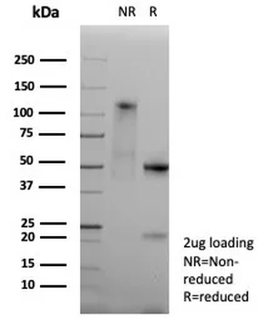HLA-DPB1 Antibody