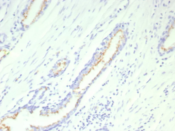 SLC45A3 Antibody