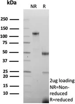 SLC45A3 Antibody