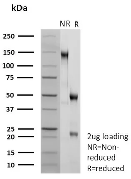 TRIM29 Antibody
