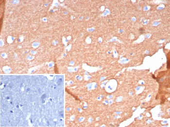 L1CAM Antibody