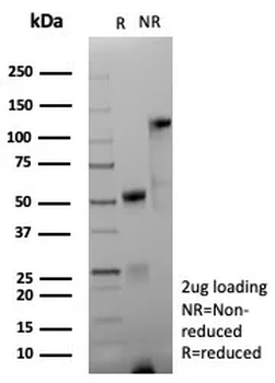 L1CAM Antibody