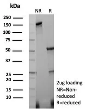 Caspase 3 (Pro & Active Form) Antibody