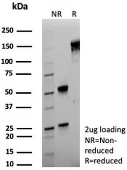 S100A4 / Metastasin / Calvasculin (Marker of Tumor Metastasis) Antibody