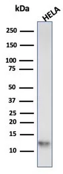 S100A4 / Metastasin / Calvasculin (Marker of Tumor Metastasis) Antibody