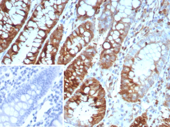 STMN1 Antibody