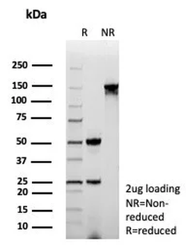 STMN1 Antibody
