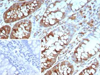STMN1 Antibody