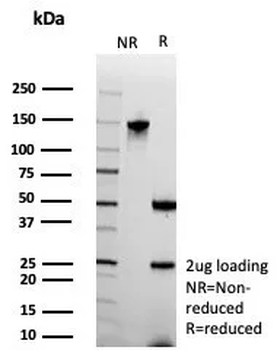 STMN1 Antibody