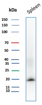 STMN1 Antibody