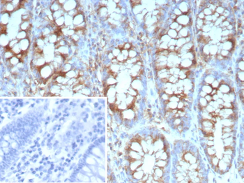 STMN1 Antibody