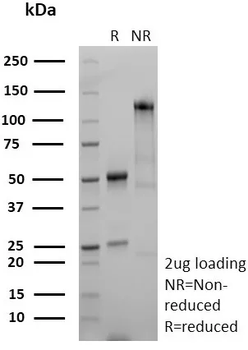 STMN1 Antibody