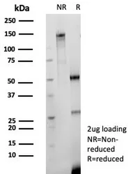 Recombinant CD147 / EMMPRIN / Neurothelin Antibody