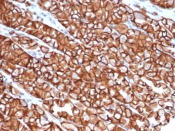 CDH1 Antibody