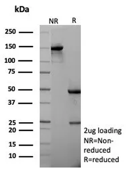 CDH1 Antibody