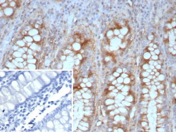 CDH1 Antibody