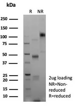 CDH1 Antibody