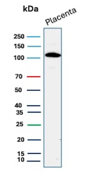 CDH1 Antibody