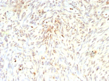 MDM2 Antibody