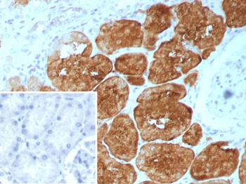 FABP1 Antibody