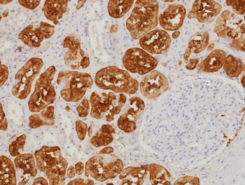 FABP1 Antibody