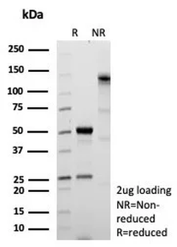 FABP1 Antibody