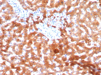 AKR1C1 Antibody
