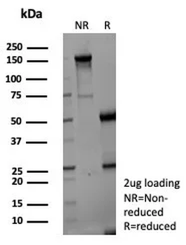 AKR1C1 Antibody