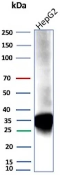 AKR1C1 Antibody