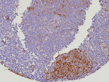 CSTA Antibody