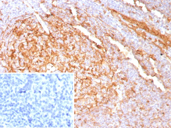 CSTA Antibody
