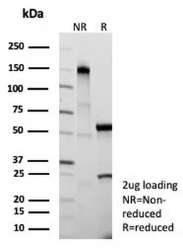 CSTA Antibody