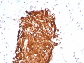 INHA Antibody