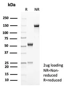 Interleukin-2 (IL-2) Antibody