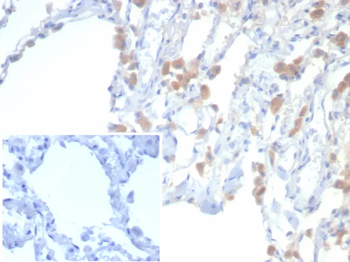 EPHB4 Antibody