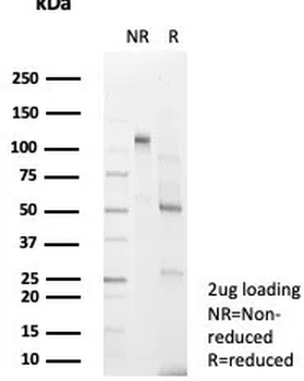DCN Antibody