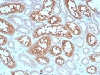 ADCY8 Antibody