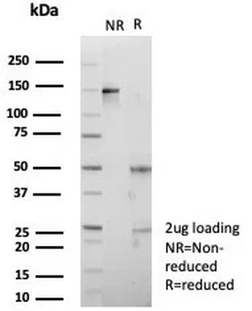 IGF2BP2 Antibody