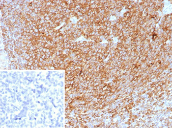 HLA-DPB1 Antibody