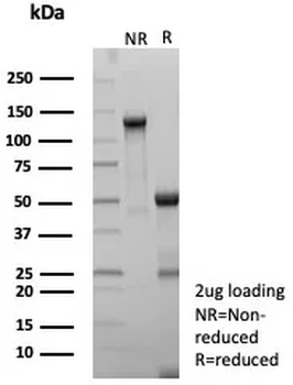 HLA-DPB1 Antibody