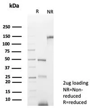 Recombinant PAX8 (Renal Cell Marker) Antibody