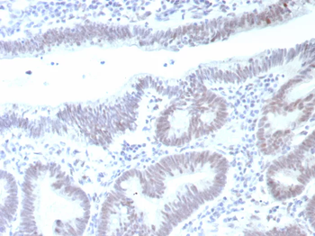TP53 Antibody