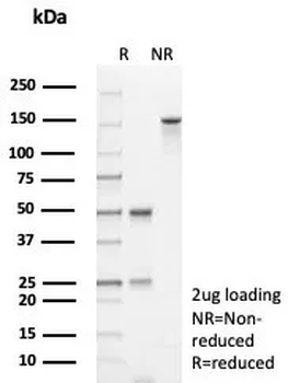 TP53 Antibody