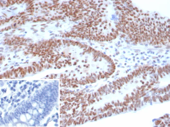 TP53 Antibody