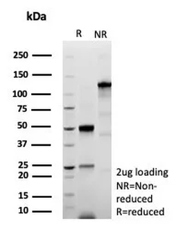 TP53 Antibody