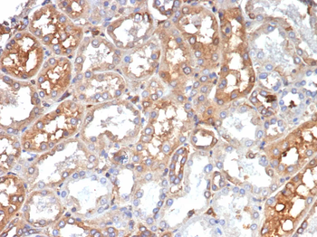 TF Antibody