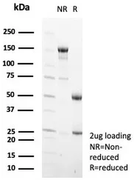 TF Antibody