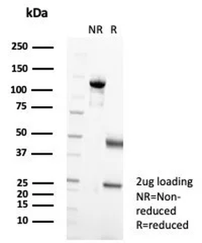 CD207 Antibody