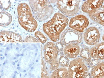 KCNIP2 Antibody