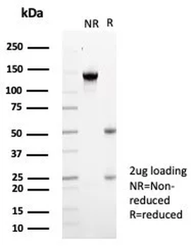 KCNIP2 Antibody